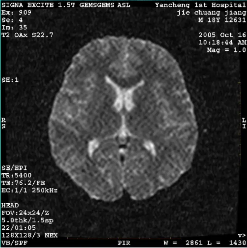 ARTIFACT WI/Fiesta Image Picteilíní Bán